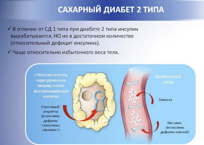 Диабет второго типа