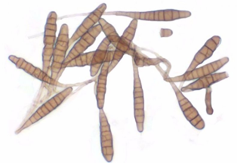 Alternaria solani